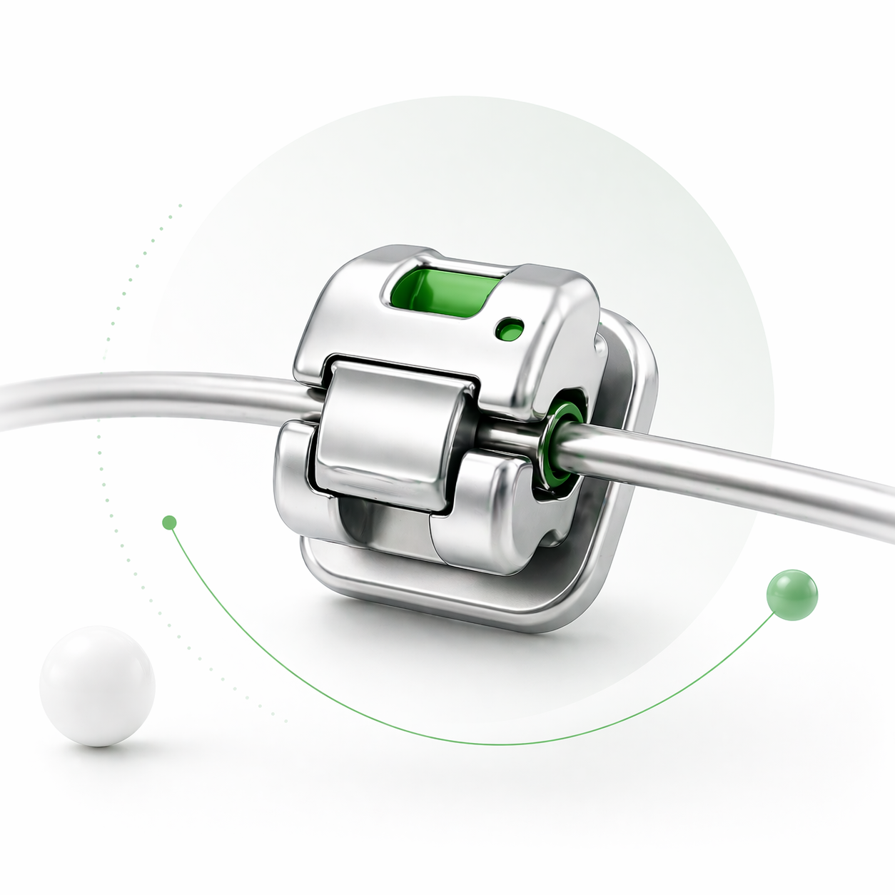 Self-Ligating Braces illustration