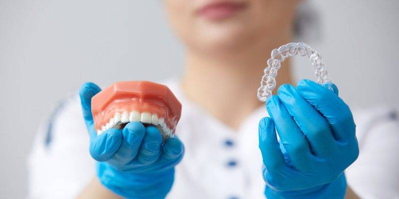 patient stories, orthodontist showing model of human jaw with wire braces and aligners explaining the difference